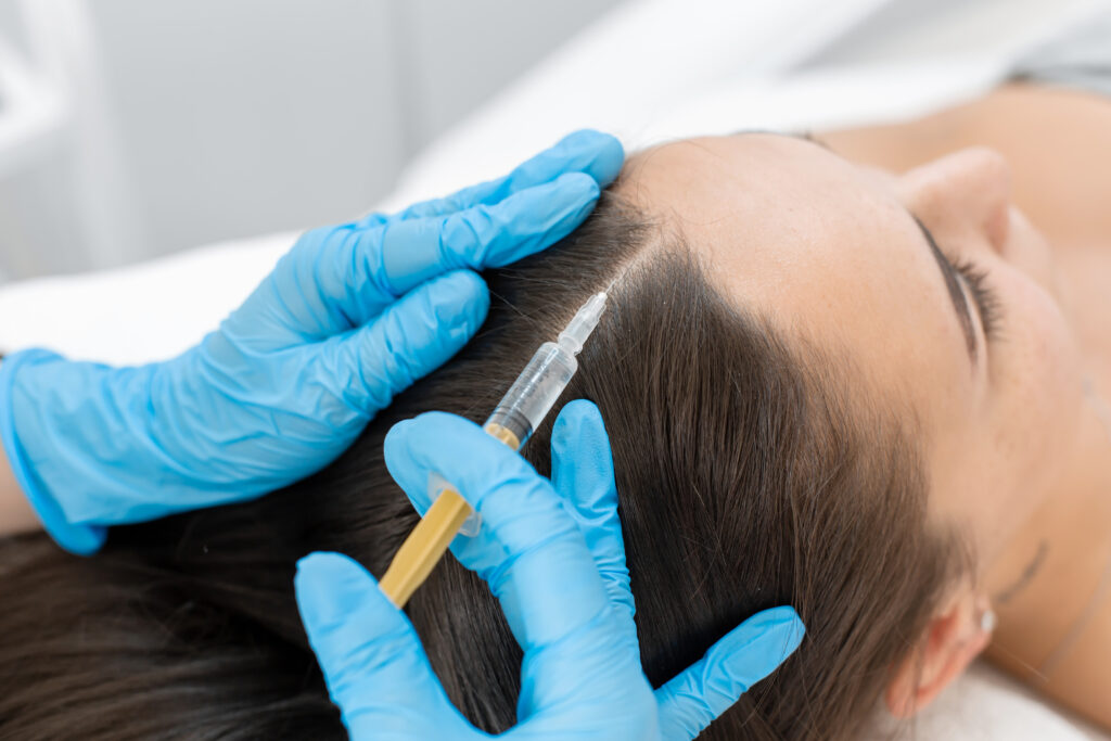 scalp prp treatment