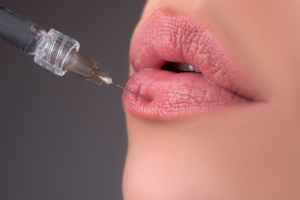Lips augmentation. Syringe female mouth, hyaluronic acid injection. Age changes. Cosmetology Treatment.